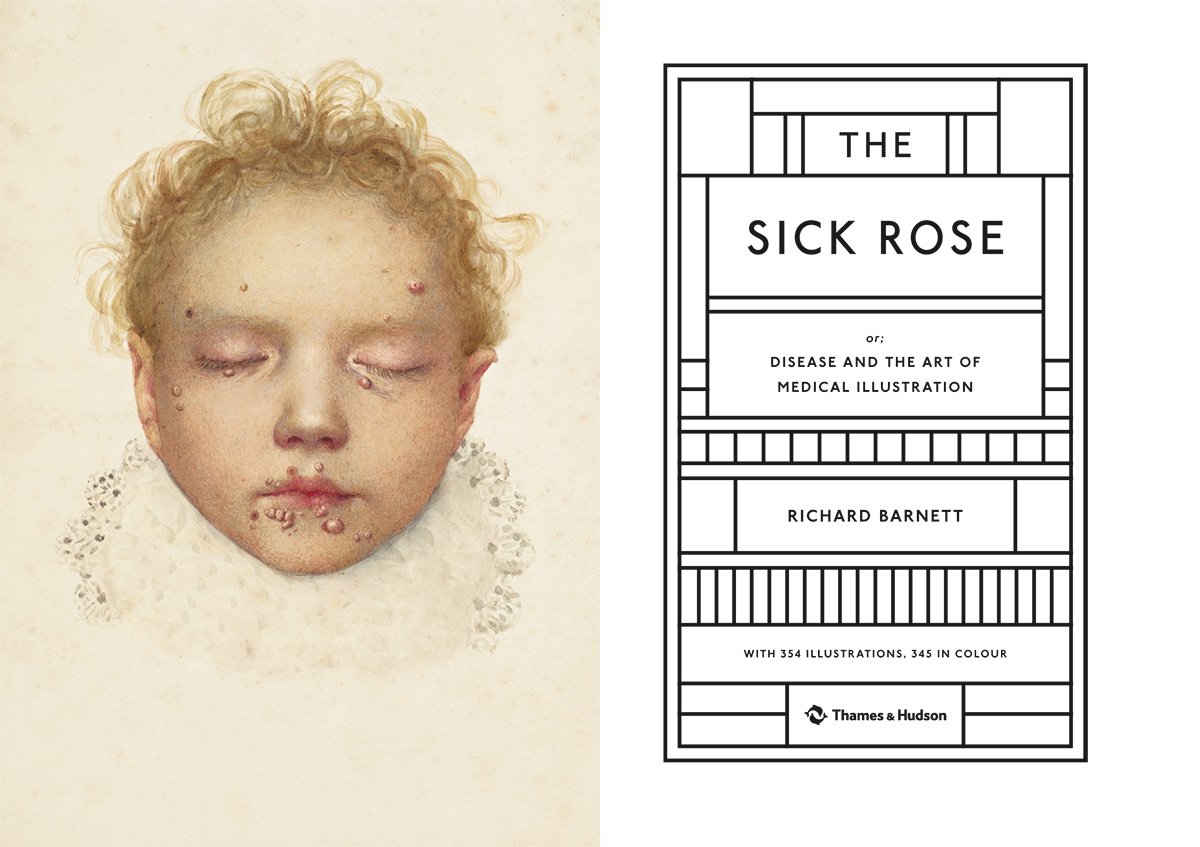 The Sick Rose